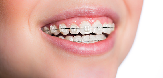 Drs. Shire and Schmidt Offer Comprehensive Orthodontic Care